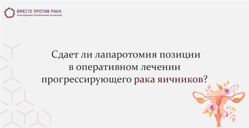 Конфиденциальность на дороге: лучшие тактики от эксперта